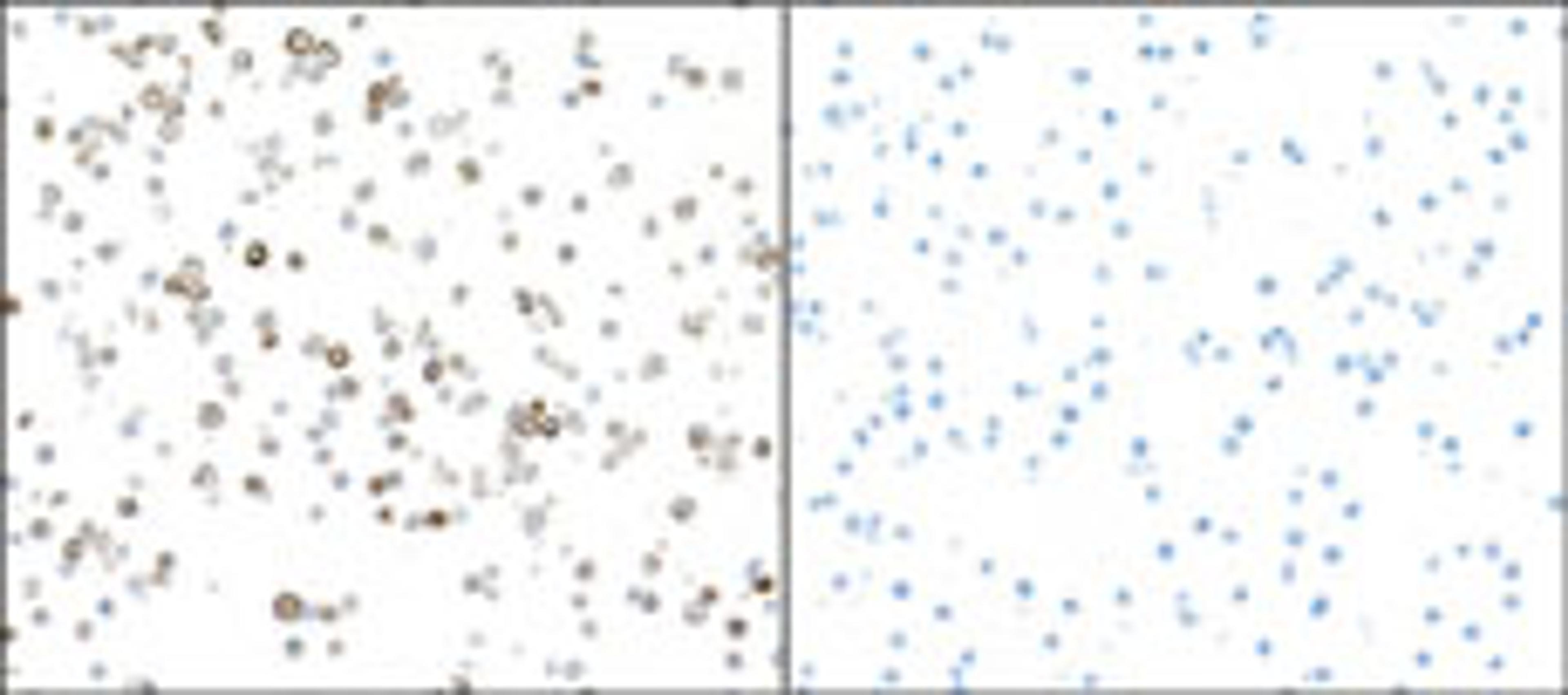 Detection of mouse iNOS in RAW264.7 cells treated with LPS (left) and untreated (right) by ICC.
