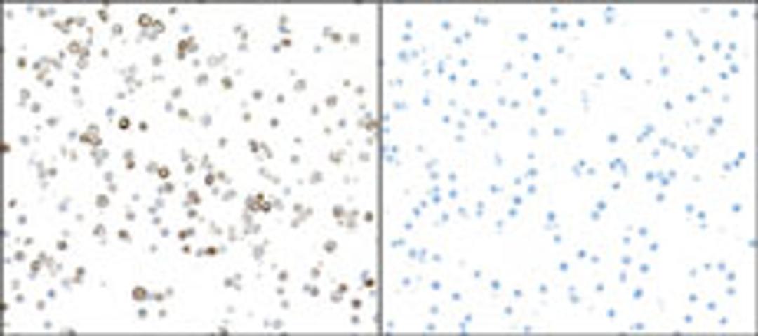 Detection of mouse iNOS in RAW264.7 cells treated with LPS (left) and untreated (right) by ICC.