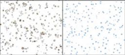 Detection of mouse iNOS in RAW264.7 cells treated with LPS (left) and untreated (right) by ICC.