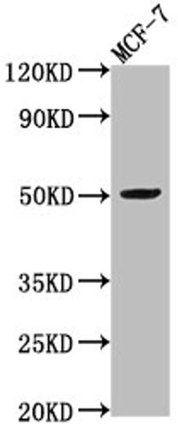 Western Blot. Positive WB detected in: MCF-7 whole cell lysate. All lanes: VIPR2 antibody at 1:2000. Secondary. Goat polyclonal to rabbit IgG at 1/50000 dilution. Predicted band size: 50, 47 kDa. Observed band size: 50 kDa. 