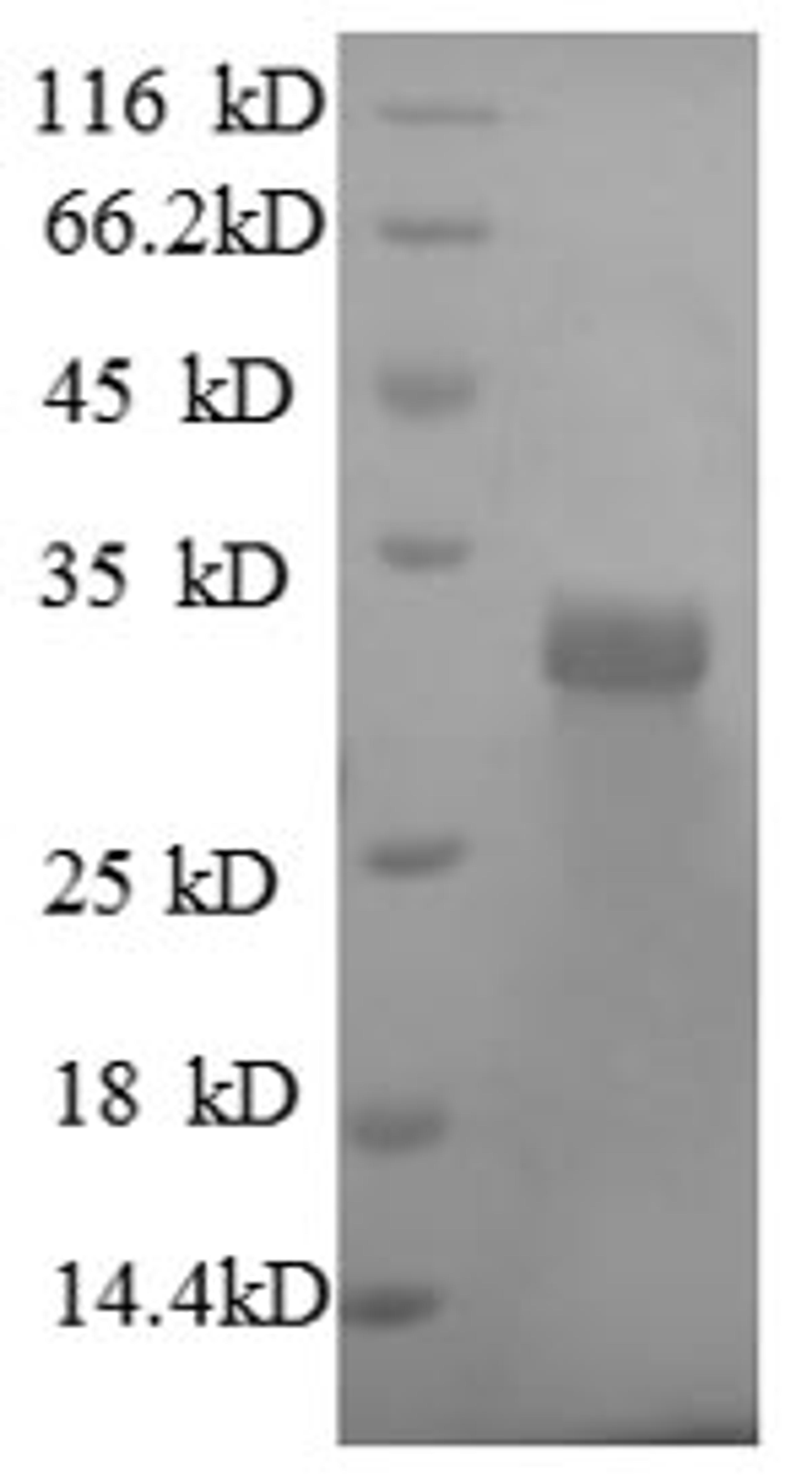 (Tris-Glycine gel) Discontinuous SDS-PAGE (reduced) with 5% enrichment gel and 15% separation gel.