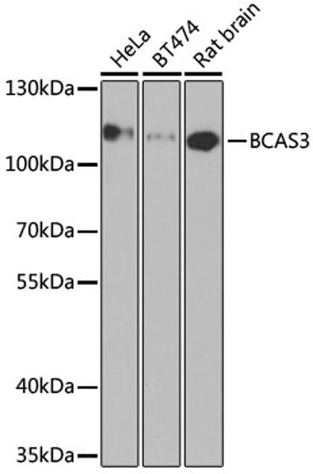 Western blot - BCAS3 antibody (A7274)