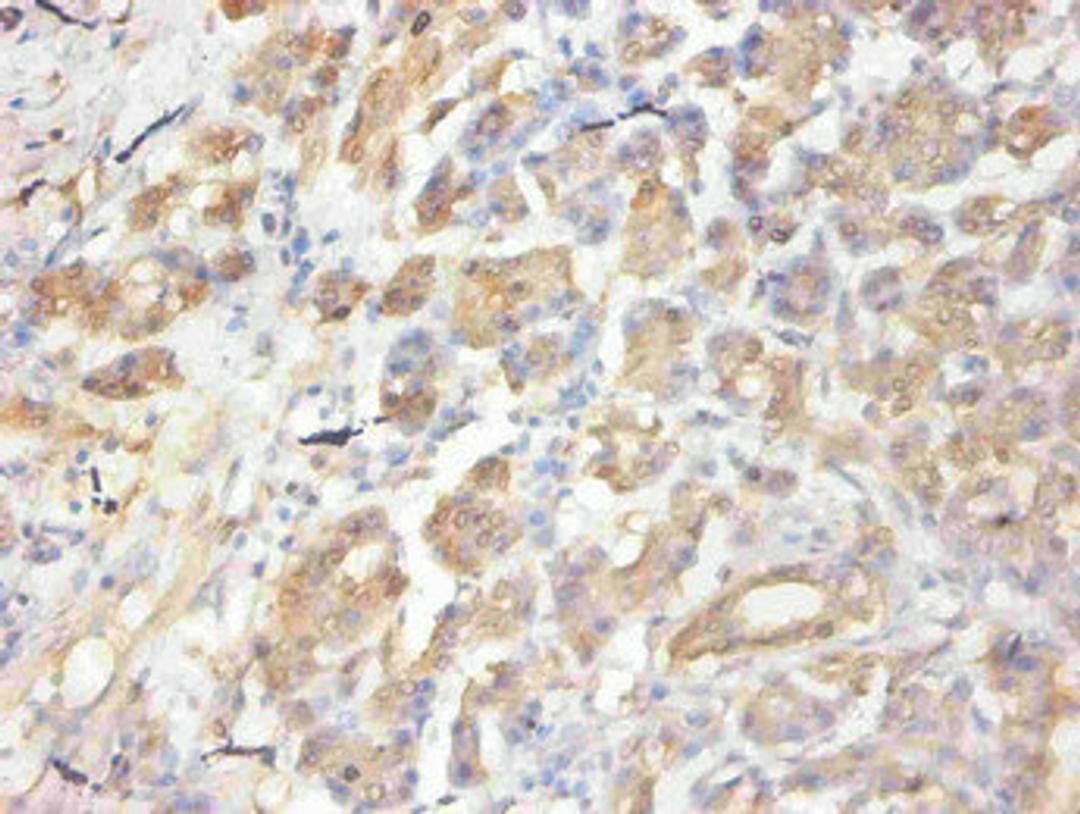 Immunohistochemical of paraffin-embedded human pancreas  using CSB-MA058641A0m at dilution of 1:50
