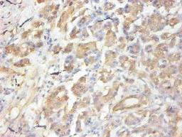 Immunohistochemical of paraffin-embedded human pancreas  using CSB-MA058641A0m at dilution of 1:50