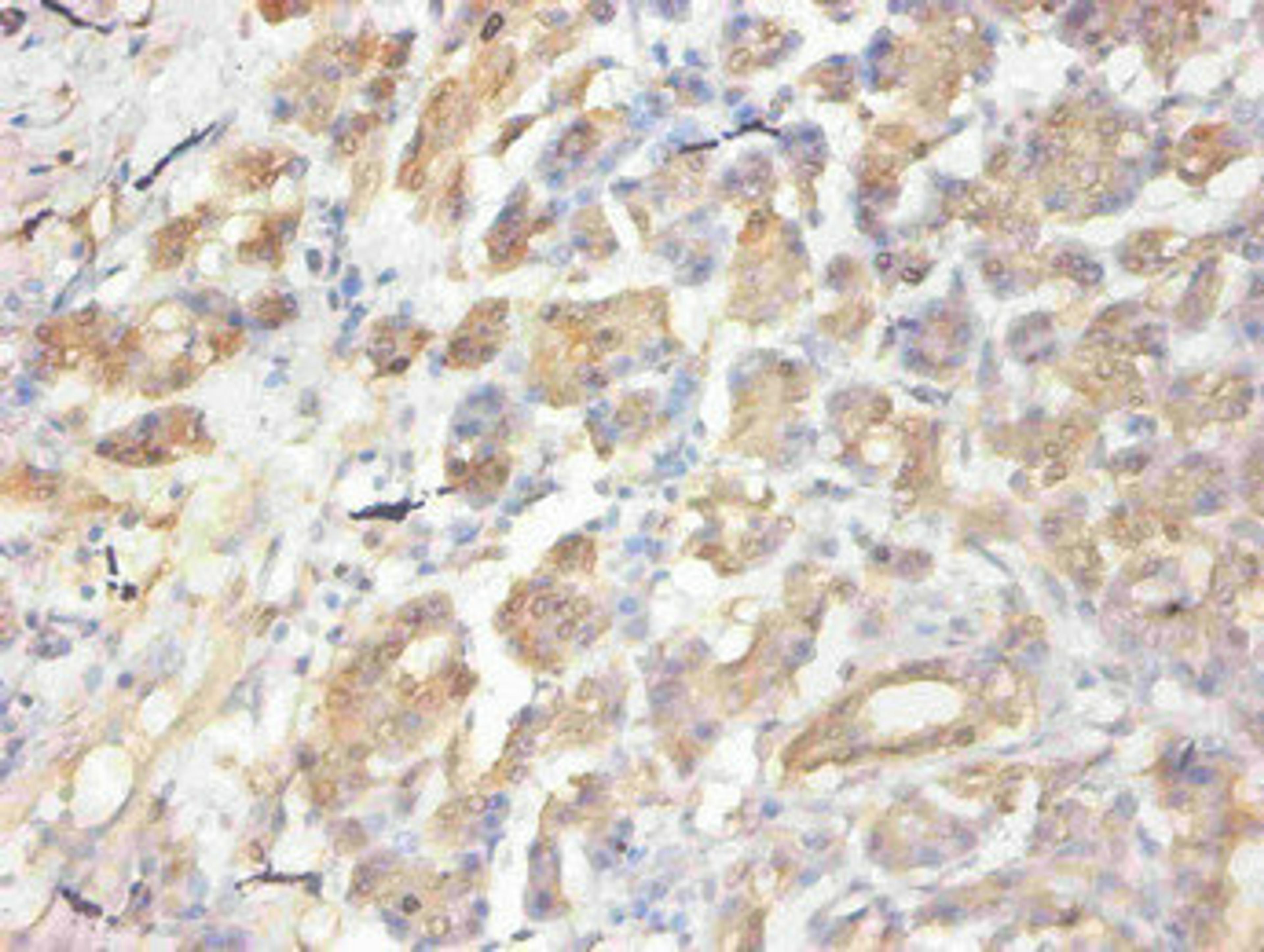 Immunohistochemical of paraffin-embedded human pancreas  using CSB-MA058641A0m at dilution of 1:50