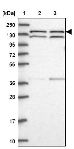 Western Blot: DHX38 Antibody [NBP1-85269] - Lane 1: Marker [kDa] 250, 130, 95, 72, 55, 36, 28, 17, 10<br/>Lane 2: Human cell line RT-4<br/>Lane 3: Human cell line U-251MG sp