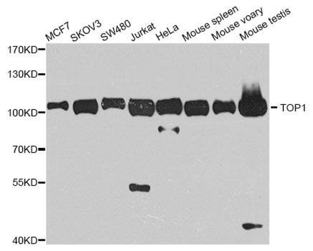 Western blot analysis of extracts of various cell lines using TOP1 antibody