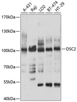 Western blot - DSC2 antibody (A10211)