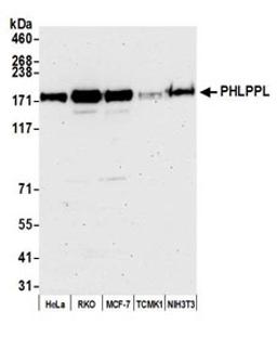 Detection of human PHLPPL by western blot.