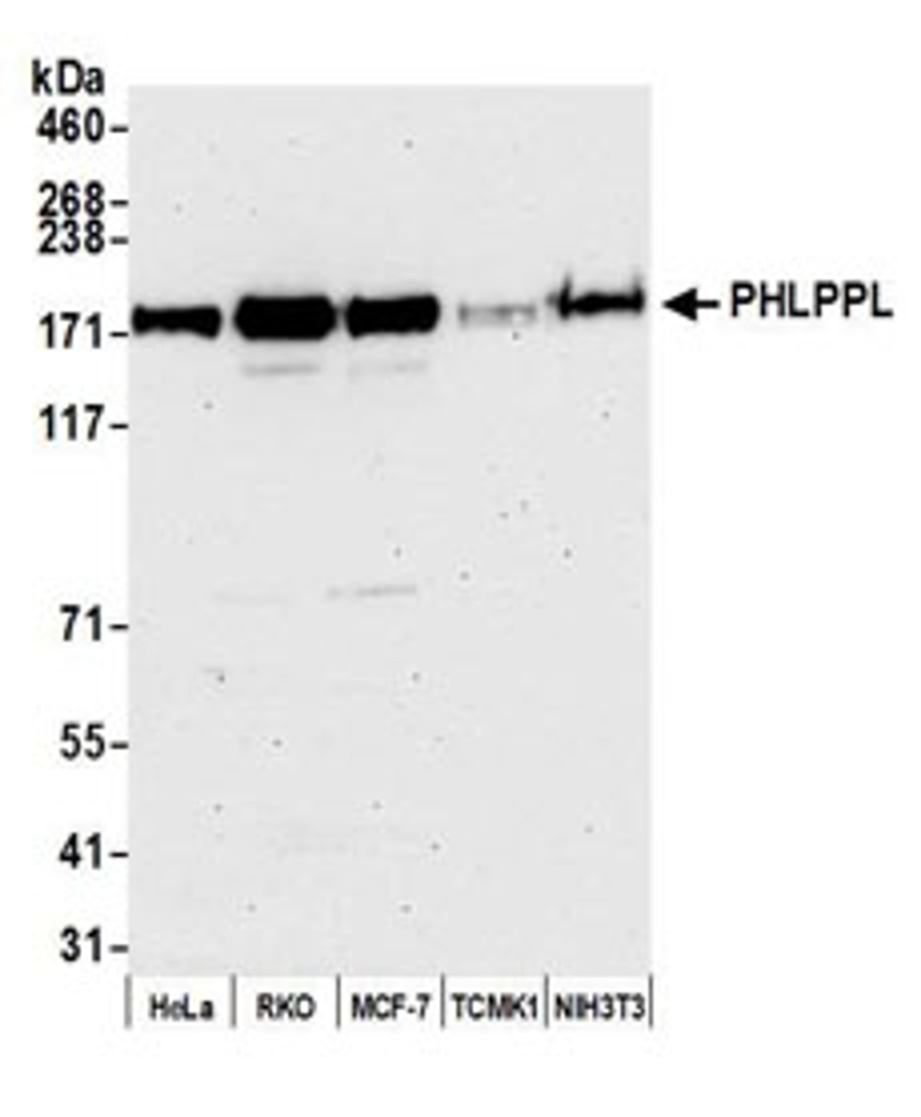 Detection of human PHLPPL by western blot.