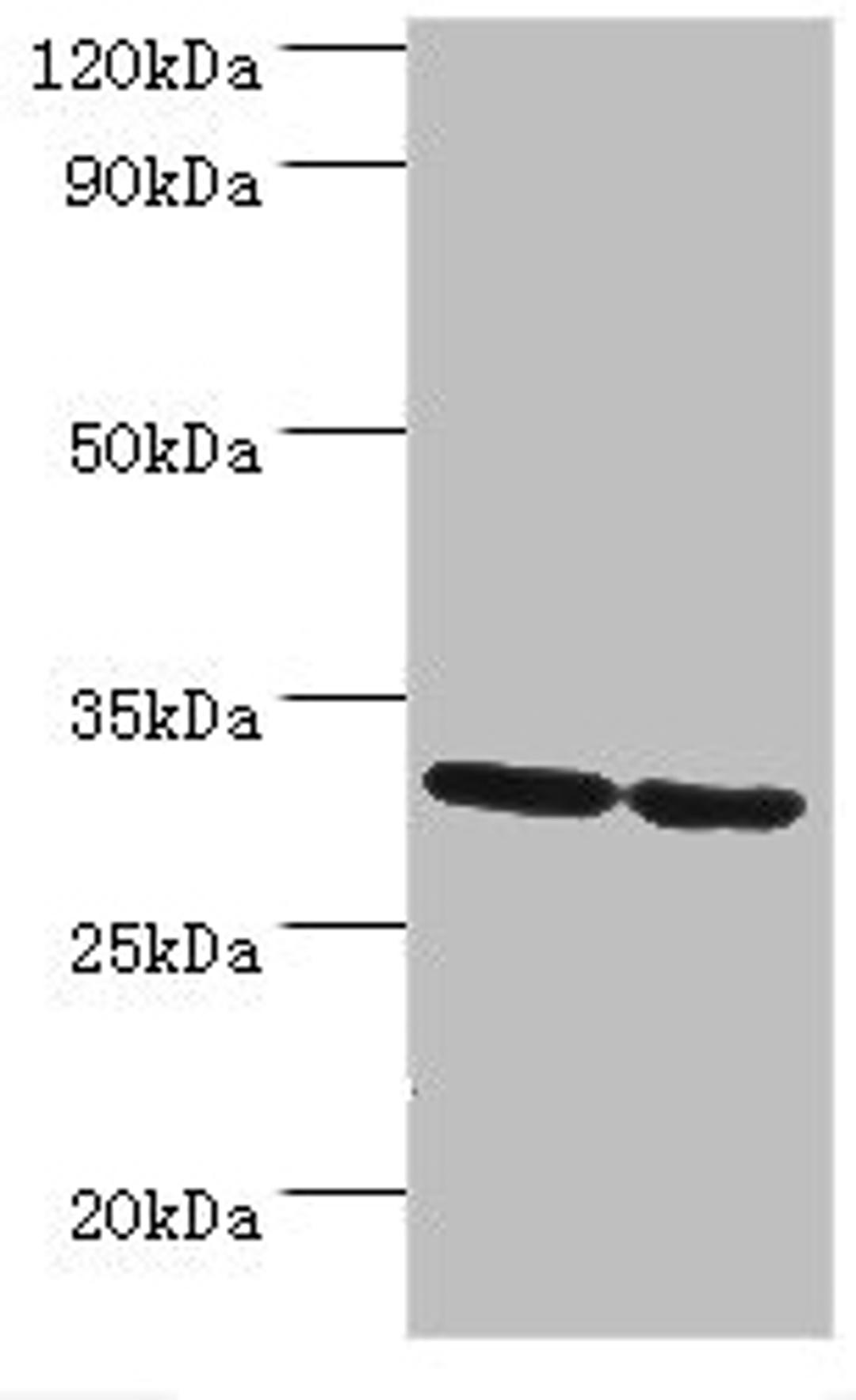 Western blot. All lanes: PNP antibody at 10µg/ml. Lane 1: Jurkat whole cell lysate. Lane 2: K562 whole cell lysate. Secondary. Goat polyclonal to rabbit IgG at 1/10000 dilution. Predicted band size: 32 kDa. Observed band size: 32 kDa