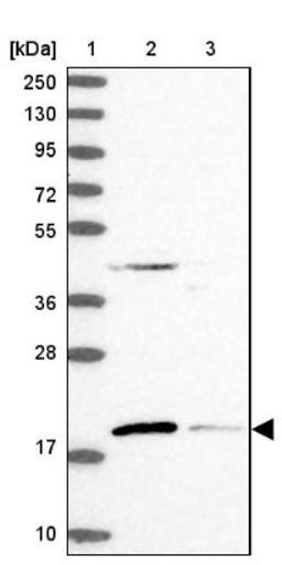 Western Blot: RMI2 Antibody [NBP1-89962] - Lane 1: Marker [kDa] 250, 130, 95, 72, 55, 36, 28, 17, 10<br/>Lane 2: Human cell line RT-4<br/>Lane 3: Human cell line U-251MG sp