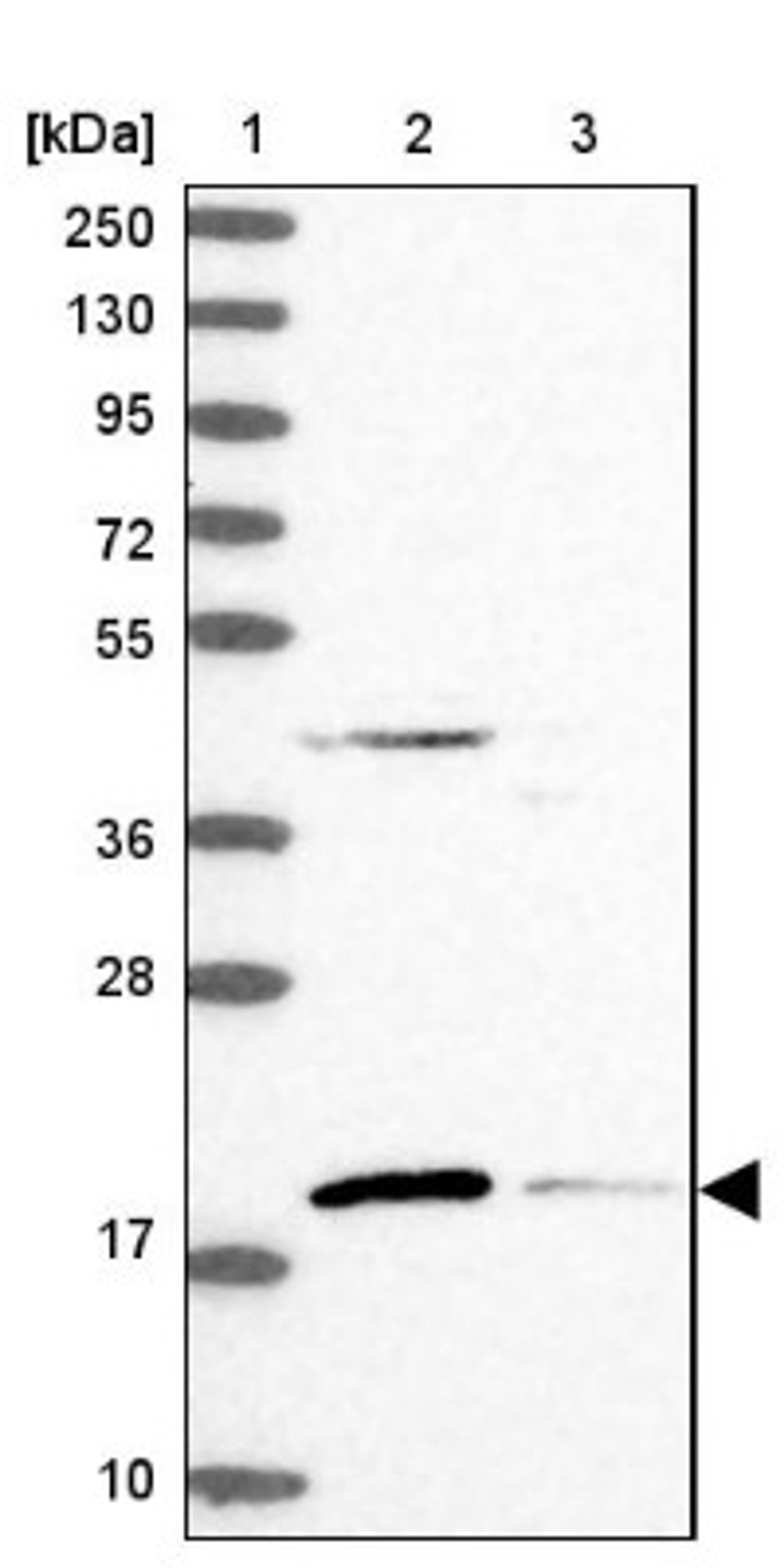 Western Blot: RMI2 Antibody [NBP1-89962] - Lane 1: Marker [kDa] 250, 130, 95, 72, 55, 36, 28, 17, 10<br/>Lane 2: Human cell line RT-4<br/>Lane 3: Human cell line U-251MG sp