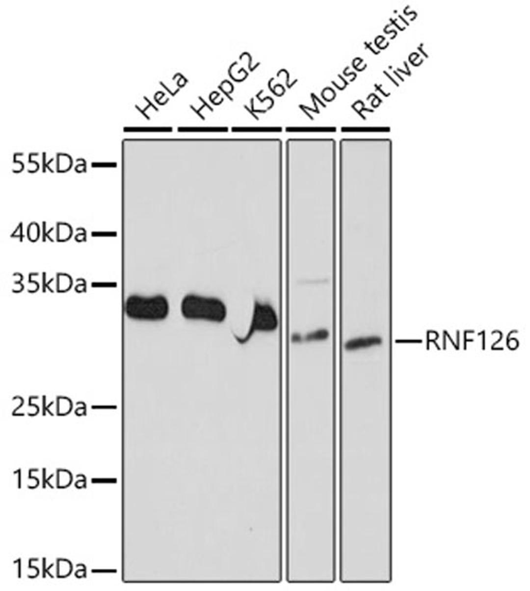 Western blot - RNF126 antibody (A20015)