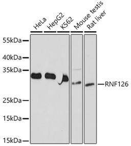 Western blot - RNF126 antibody (A20015)