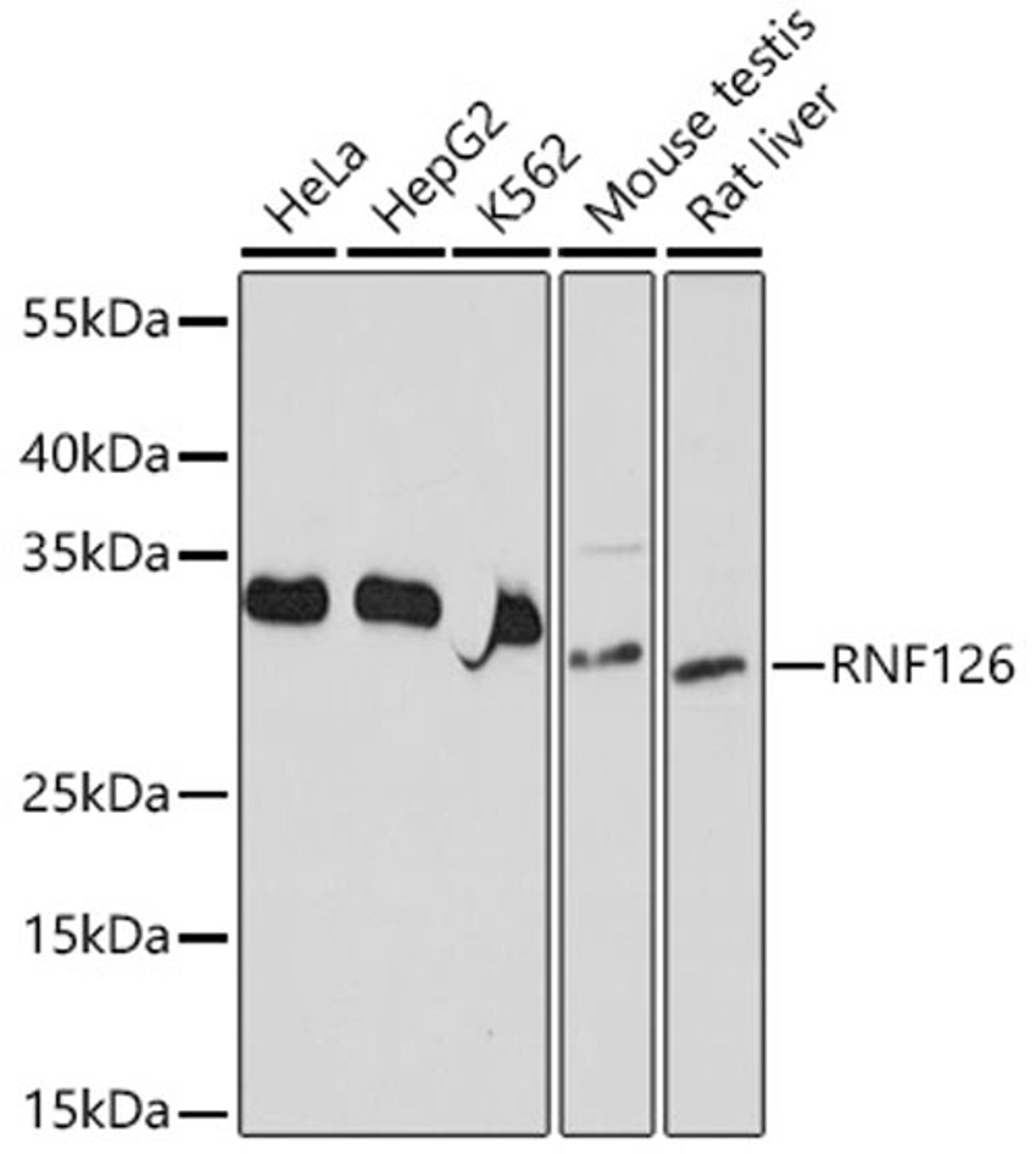 Western blot - RNF126 antibody (A20015)