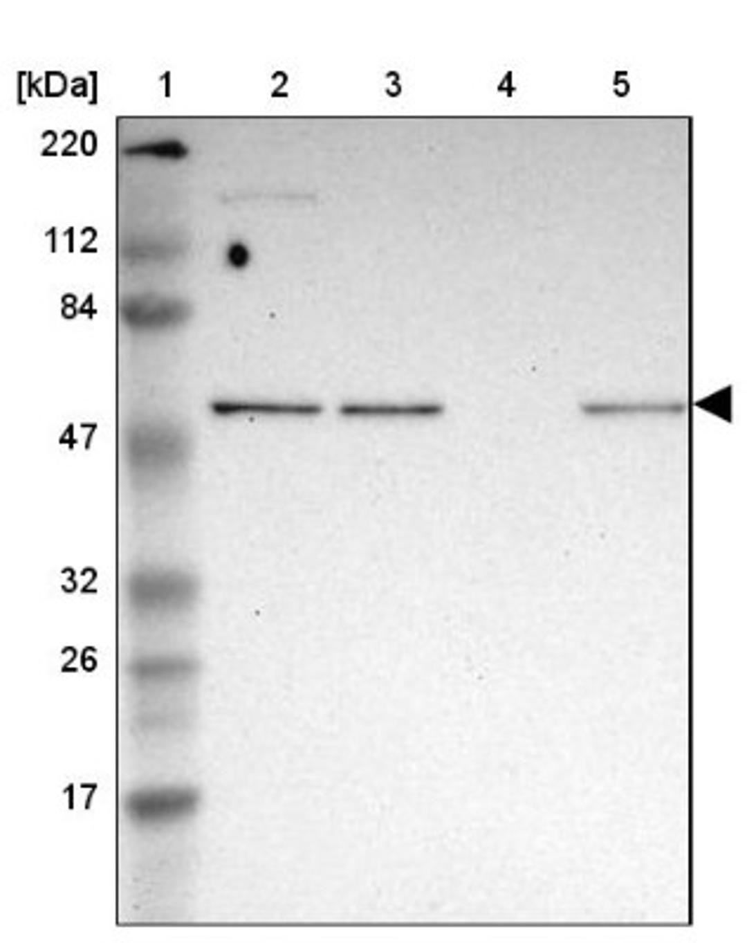 Western Blot: GABPA Antibody [NBP1-84942] - Lane 1: Marker [kDa] 220, 112, 84, 47, 32, 26, 17<br/>Lane 2: Human cell line RT-4<br/>Lane 3: Human cell line U-251MG sp<br/>Lane 4: Human liver tissue<br/>Lane 5: Human tonsil tissue