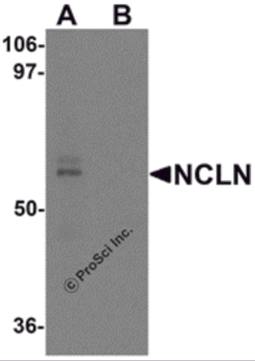 Western blot analysis of NCLN in mouse heart tissue lysate with NCLN antibody at 0.5 &#956;g/mL in (A) the absence and (B) the presence of blocking peptide.