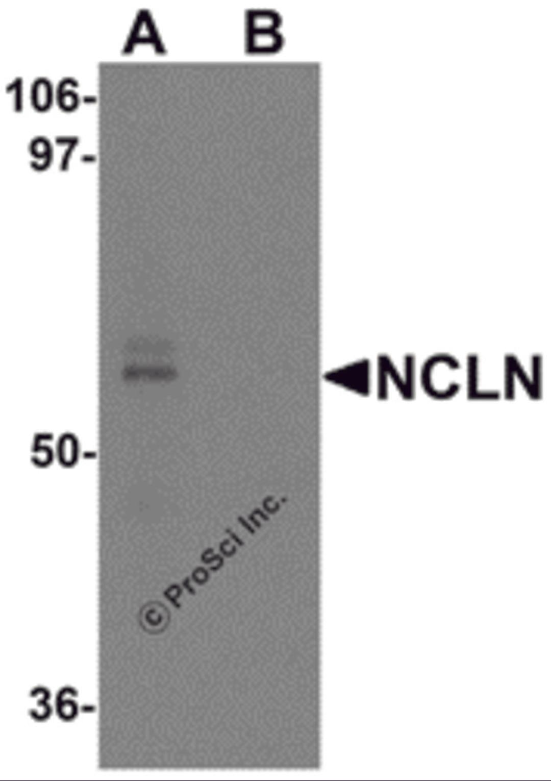 Western blot analysis of NCLN in mouse heart tissue lysate with NCLN antibody at 0.5 μg/mL in (A) the absence and (B) the presence of blocking peptide.