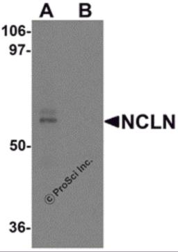 Western blot analysis of NCLN in mouse heart tissue lysate with NCLN antibody at 0.5 μg/mL in (A) the absence and (B) the presence of blocking peptide.