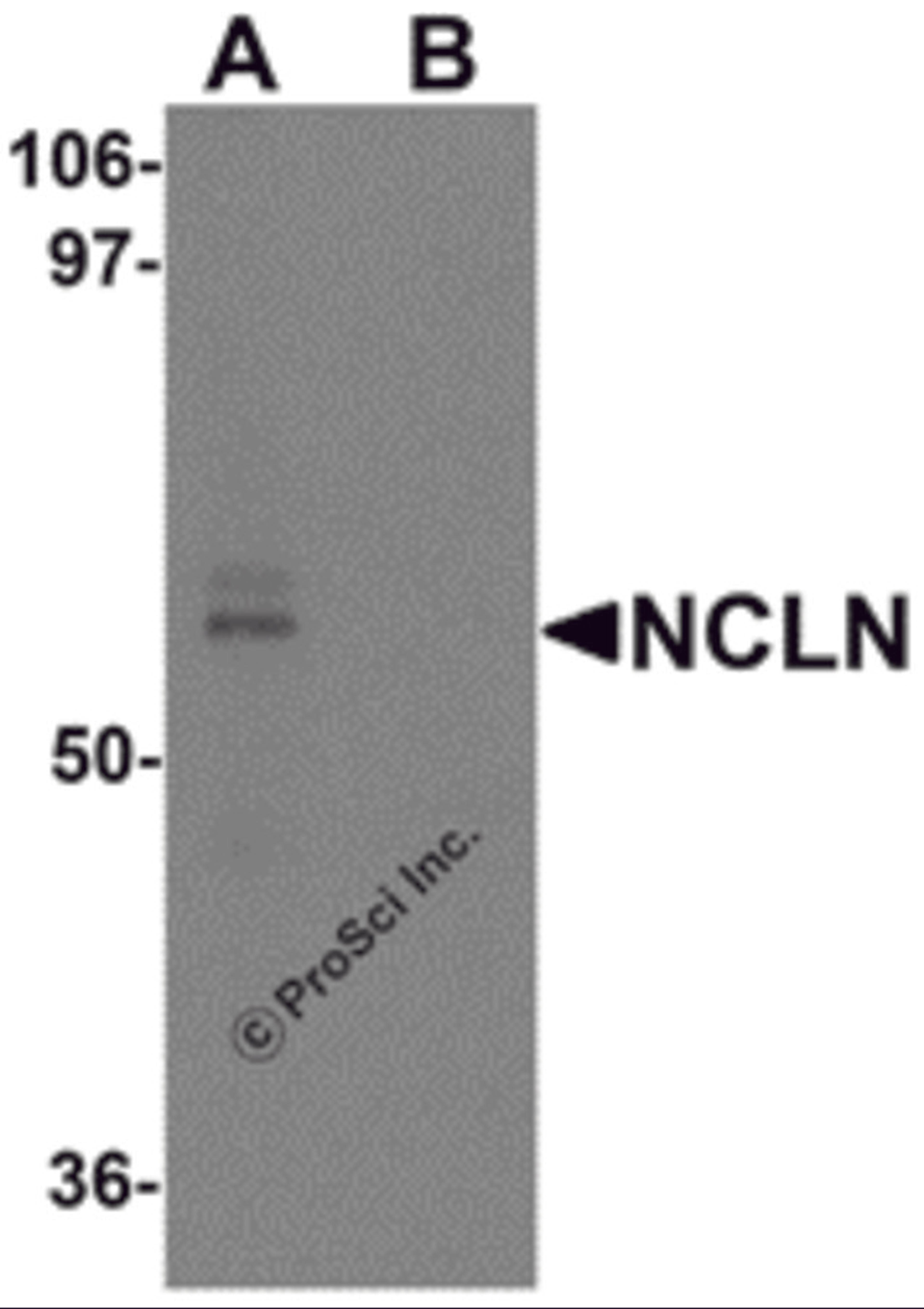 Western blot analysis of NCLN in mouse heart tissue lysate with NCLN antibody at 0.5 μg/mL in (A) the absence and (B) the presence of blocking peptide.