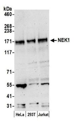 Detection of human NEK1 by western blot.