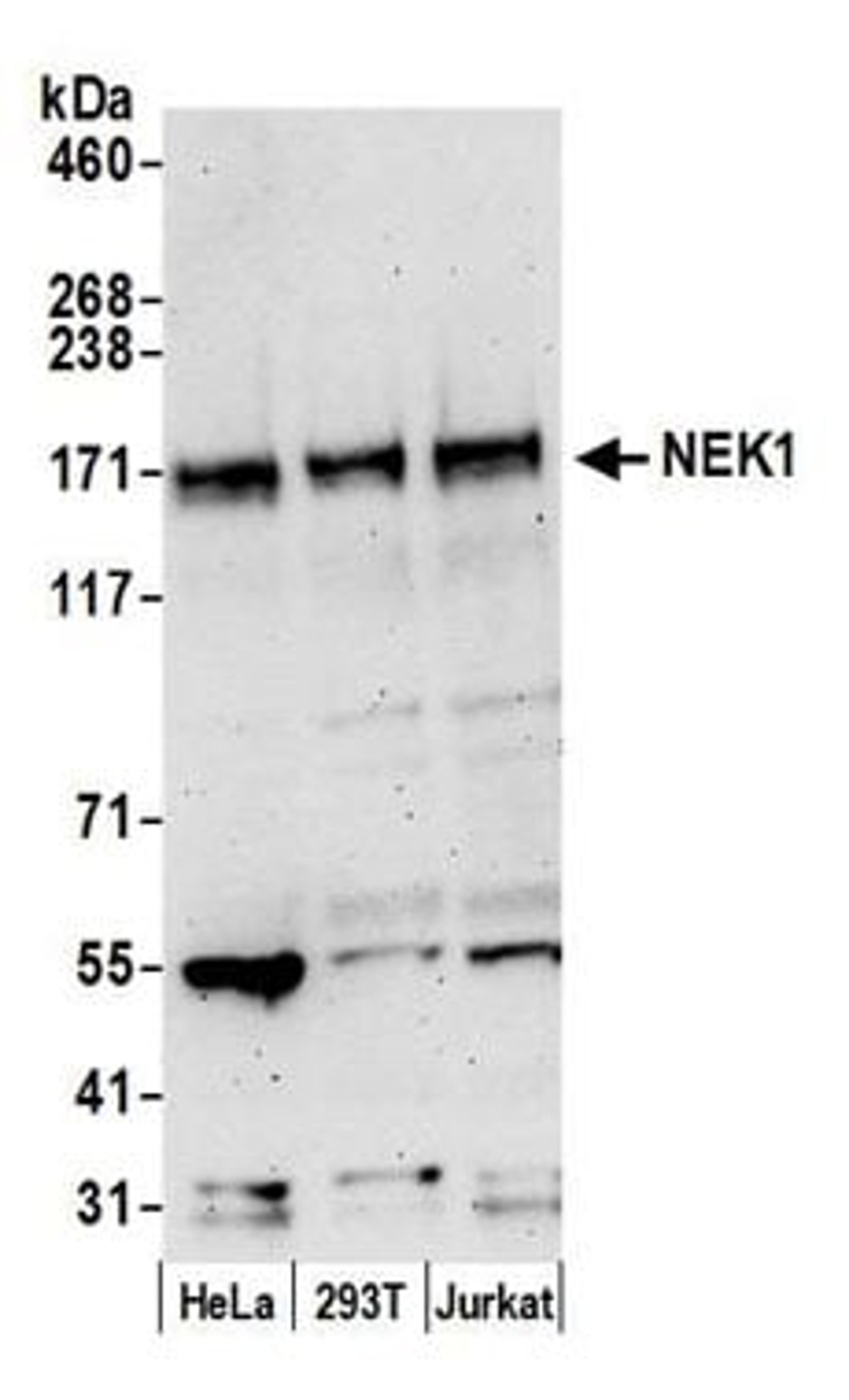 Detection of human NEK1 by western blot.