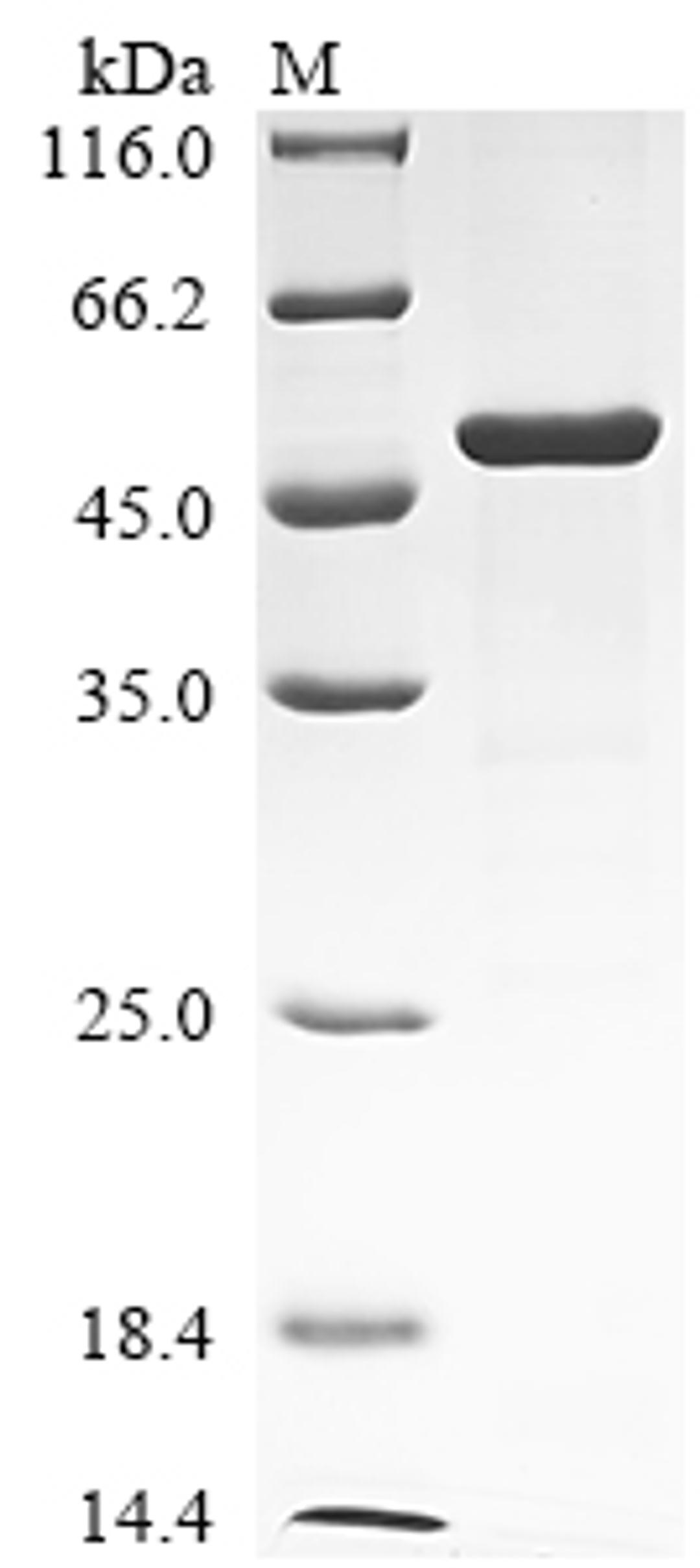 (Tris-Glycine gel) Discontinuous SDS-PAGE (reduced) with 5% enrichment gel and 15% separation gel.