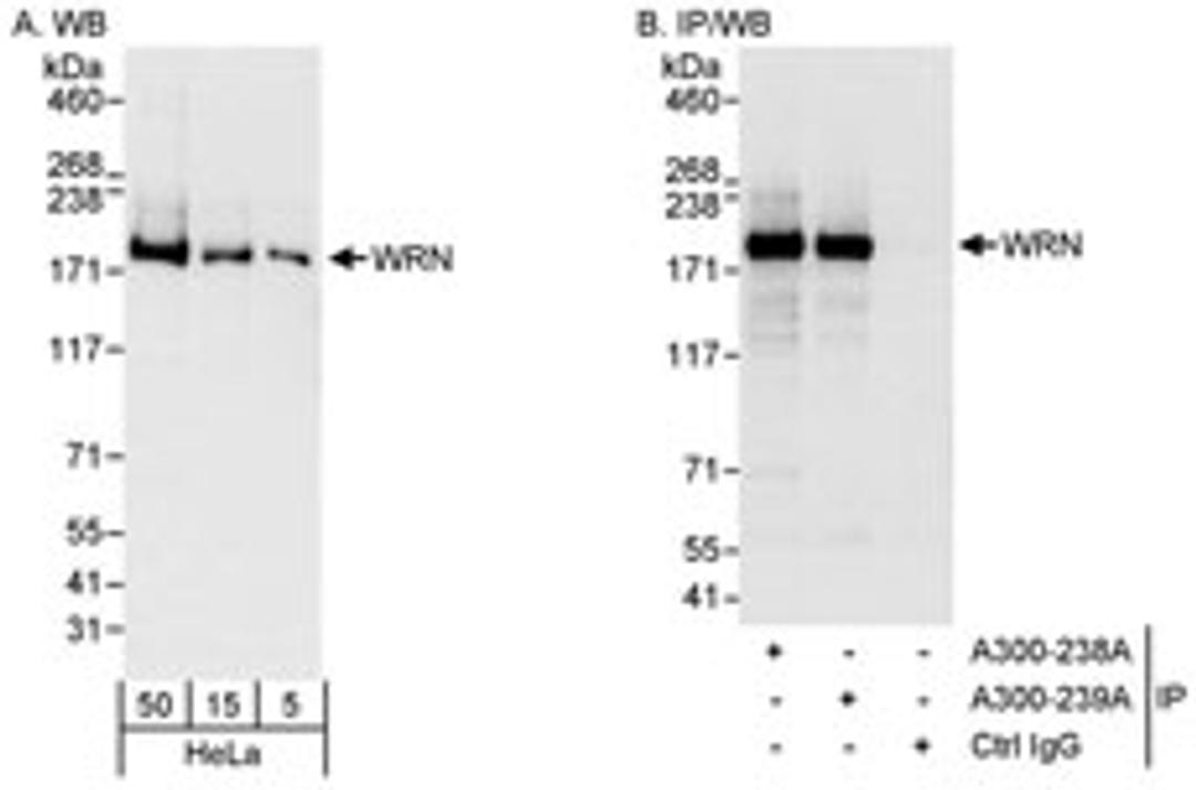 Detection of human WRN by western blot and immunoprecipitation.