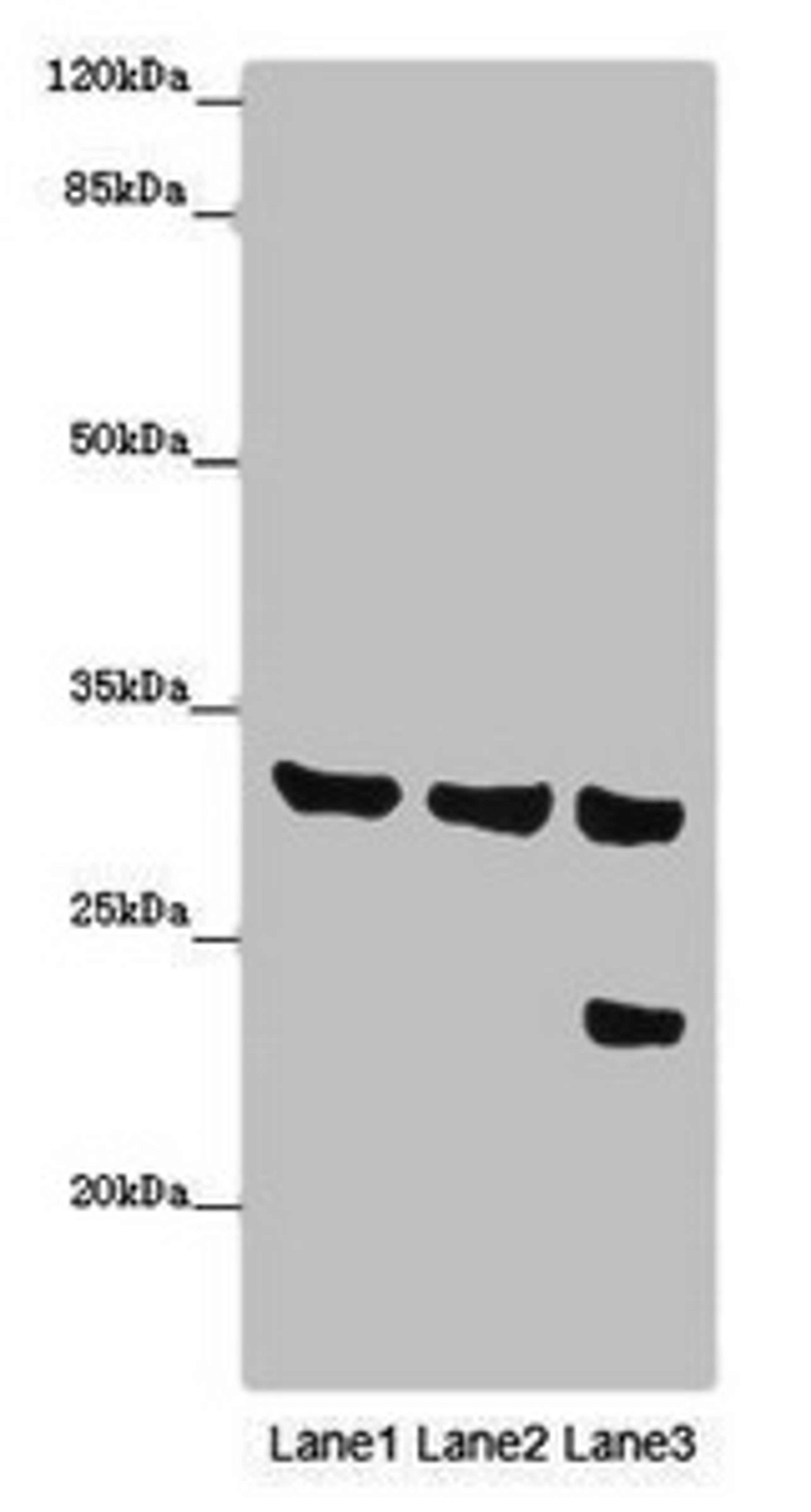 Western blot. All lanes: SLC25A10 antibody at 16µg/ml. Lane 1: Mouse liver tissue. Lane 2: Mouse kidney tissue. Lane 3: HepG2 whole cell lysate. Secondary. Goat polyclonal to rabbit IgG at 1/10000 dilution. Predicted band size: 32, 33 kDa. Observed band size: 32, 24 kDa