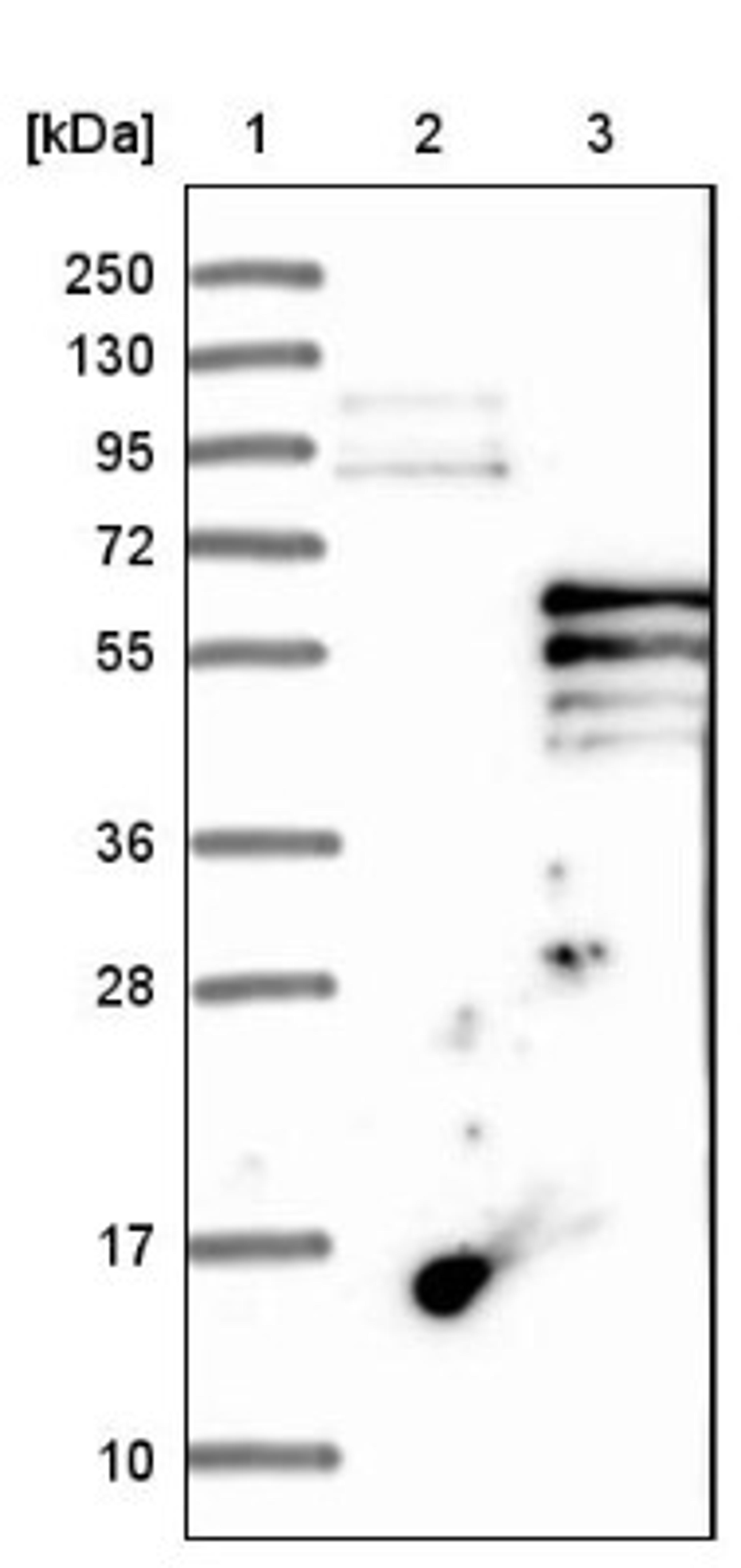 Western Blot: PI 4 Kinase type 2 beta Antibody [NBP1-87908] - Lane 1: Marker [kDa] 250, 130, 95, 72, 55, 36, 28, 17, 10<br/>Lane 2: Negative control (vector only transfected HEK293T lysate)<br/>Lane 3: Over-expression lysate (Co-expressed with a C-terminal myc-DDK tag (~3.1 kDa) in mammalian HEK293T cells, LY402666)