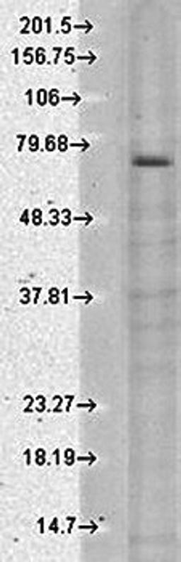 Western blot analysis of human cell line mix using TrpV3 antibody