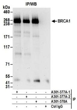 Detection of human BRCA1 by western blot of immunoprecipitates.