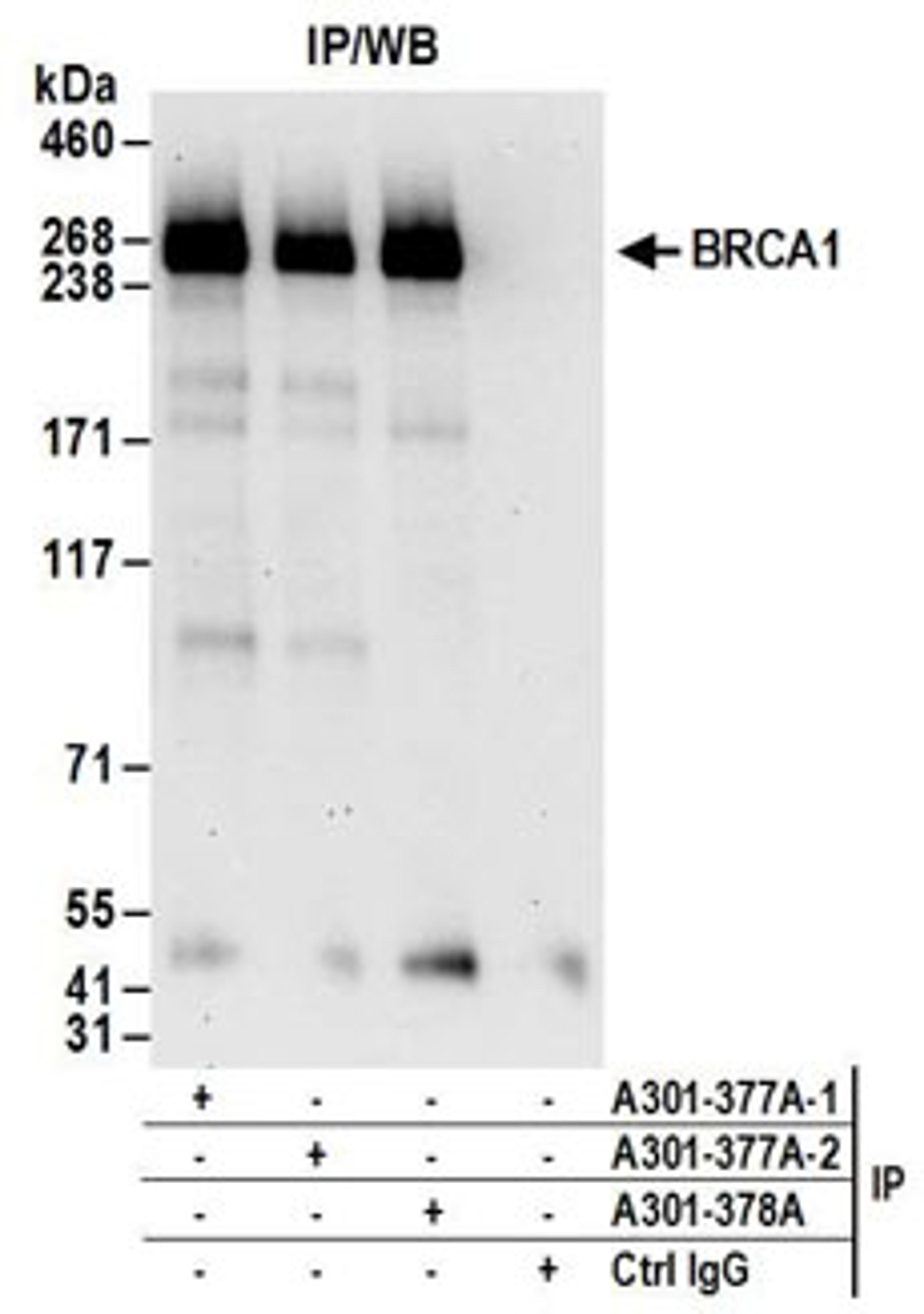 Detection of human BRCA1 by western blot of immunoprecipitates.