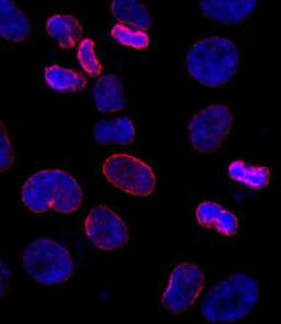 Detection of human NUP153 by immunocytochemistry.