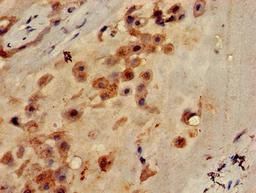 Immunohistochemistry of paraffin-embedded human placenta tissue using CSB-PA883623LA01HU at dilution of 1:100