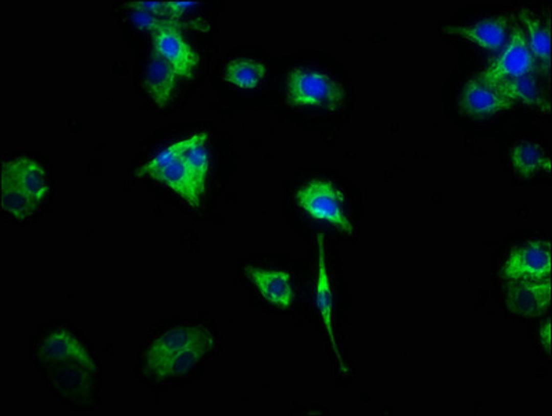 Immunofluorescence staining of HepG2 cells with CSB-PA006046LA01HU at 1:466, counter-stained with DAPI. The cells were fixed in 4% formaldehyde, permeabilized using 0.2% Triton X-100 and blocked in 10% normal Goat Serum. The cells were then incubated with the antibody overnight at 4°C. The secondary antibody was Alexa Fluor 488-congugated AffiniPure Goat Anti-Rabbit IgG(H+L).