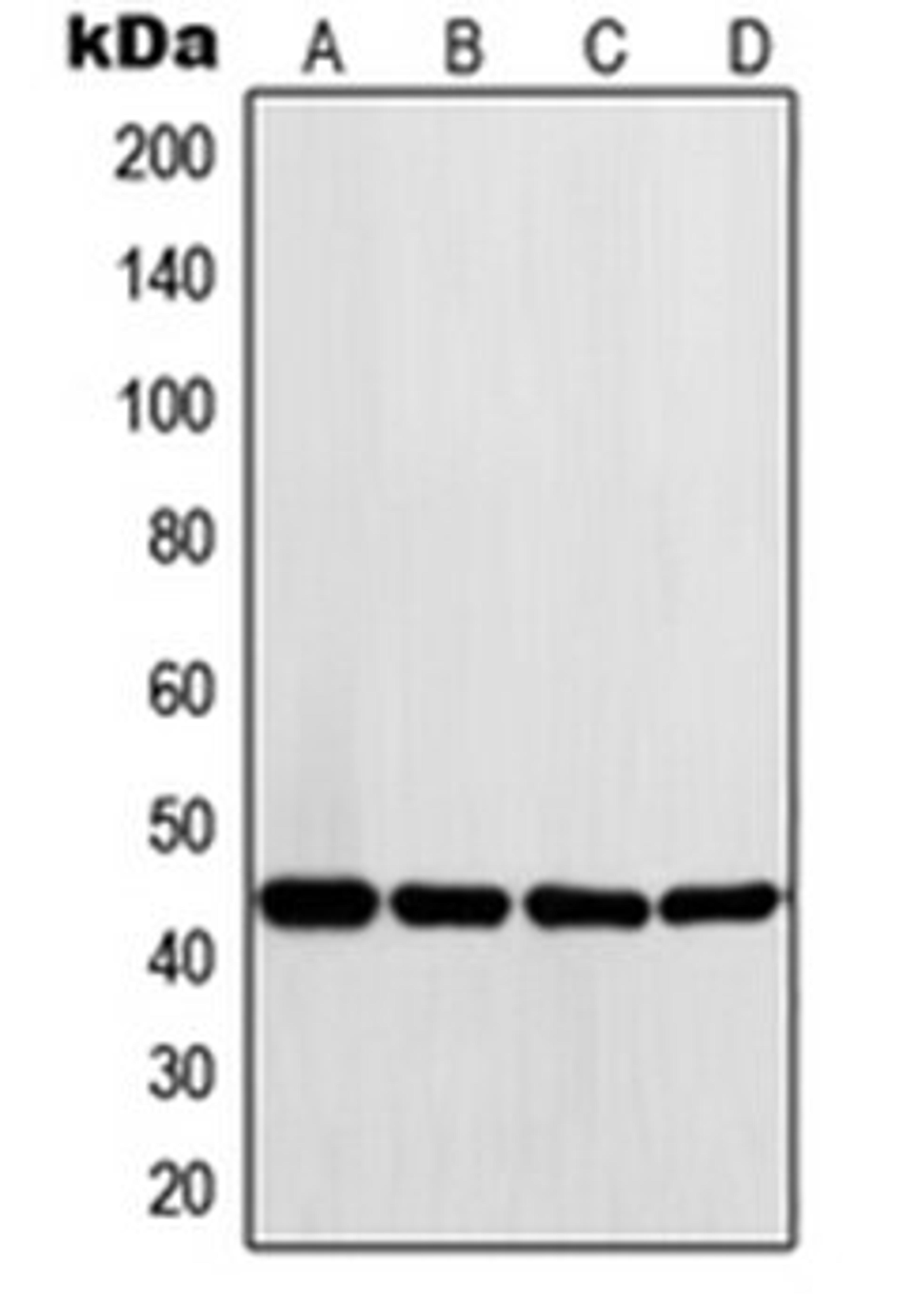 Western blot analysis of K562 (Lane 1), Ramos (Lane 2), HeLa (Lane 3), A431 (Lane 4) whole cell lysates using LYAR antibody