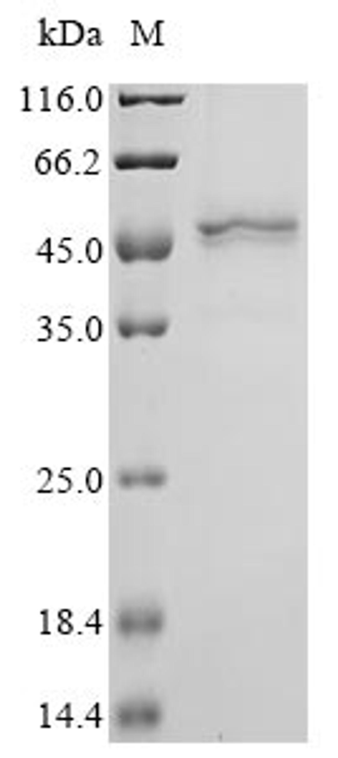 (Tris-Glycine gel) Discontinuous SDS-PAGE (reduced) with 5% enrichment gel and 15% separation gel.