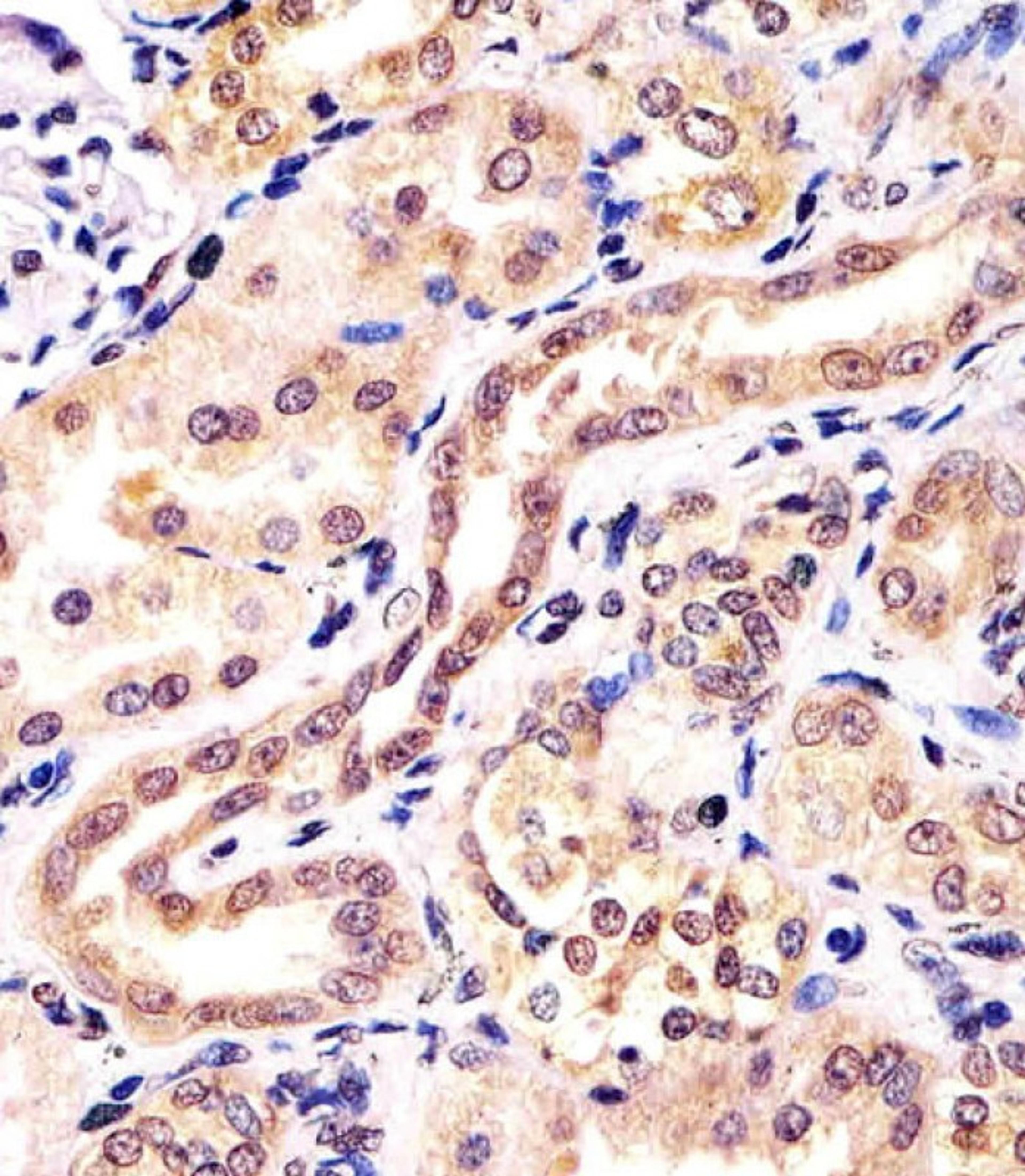 Antibody staining KCTD11 in human kidney tissue sections by Immunohistochemistry (IHC-P - paraformaldehyde-fixed, paraffin-embedded sections).