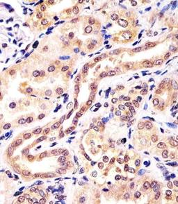 Antibody staining KCTD11 in human kidney tissue sections by Immunohistochemistry (IHC-P - paraformaldehyde-fixed, paraffin-embedded sections).