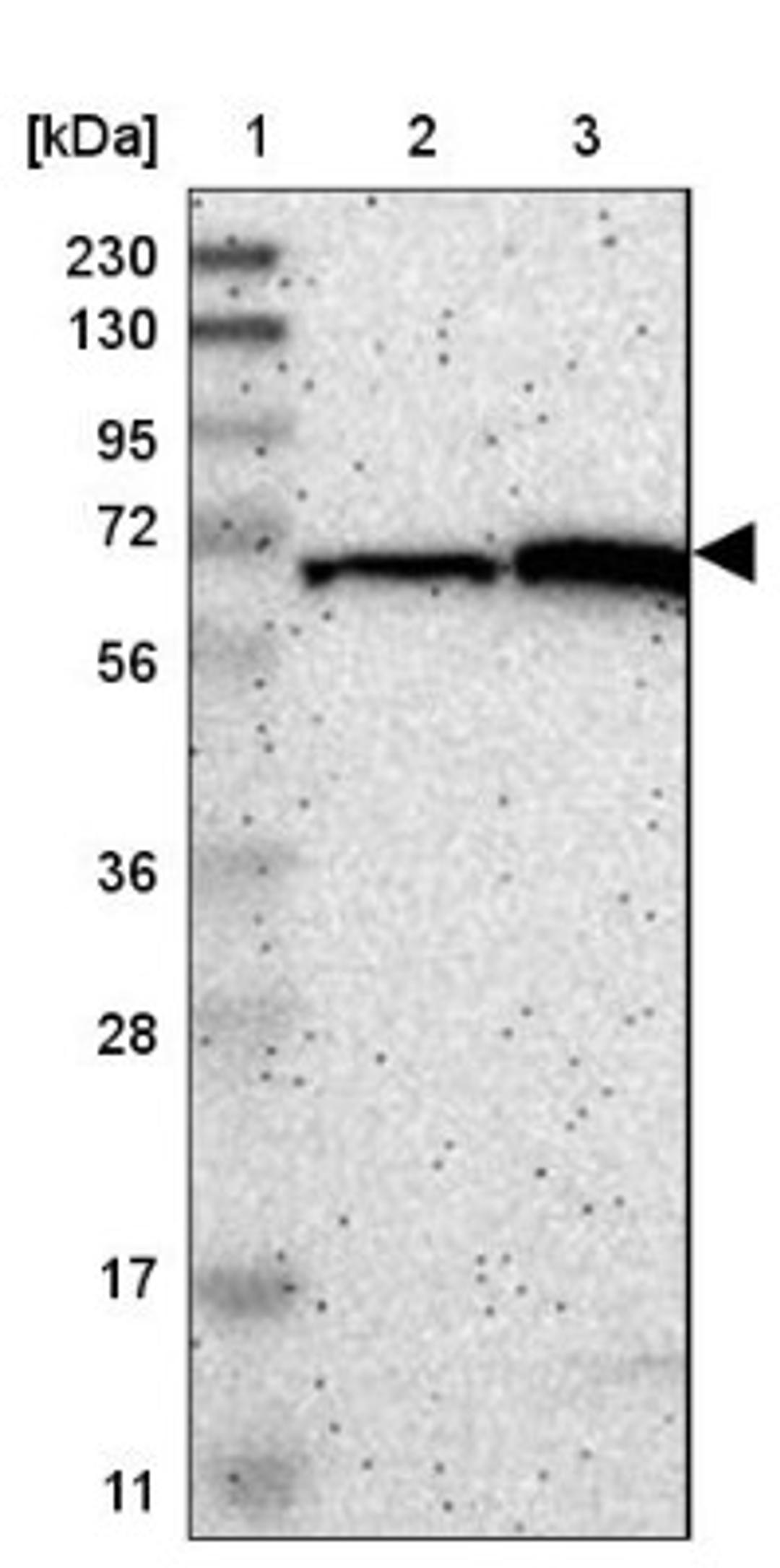 Western Blot: ME2 Antibody [NBP1-89559] - Lane 1: Marker [kDa] 230, 130, 95, 72, 56, 36, 28, 17, 11<br/>Lane 2: Human cell line RT-4<br/>Lane 3: Human cell line U-251MG sp