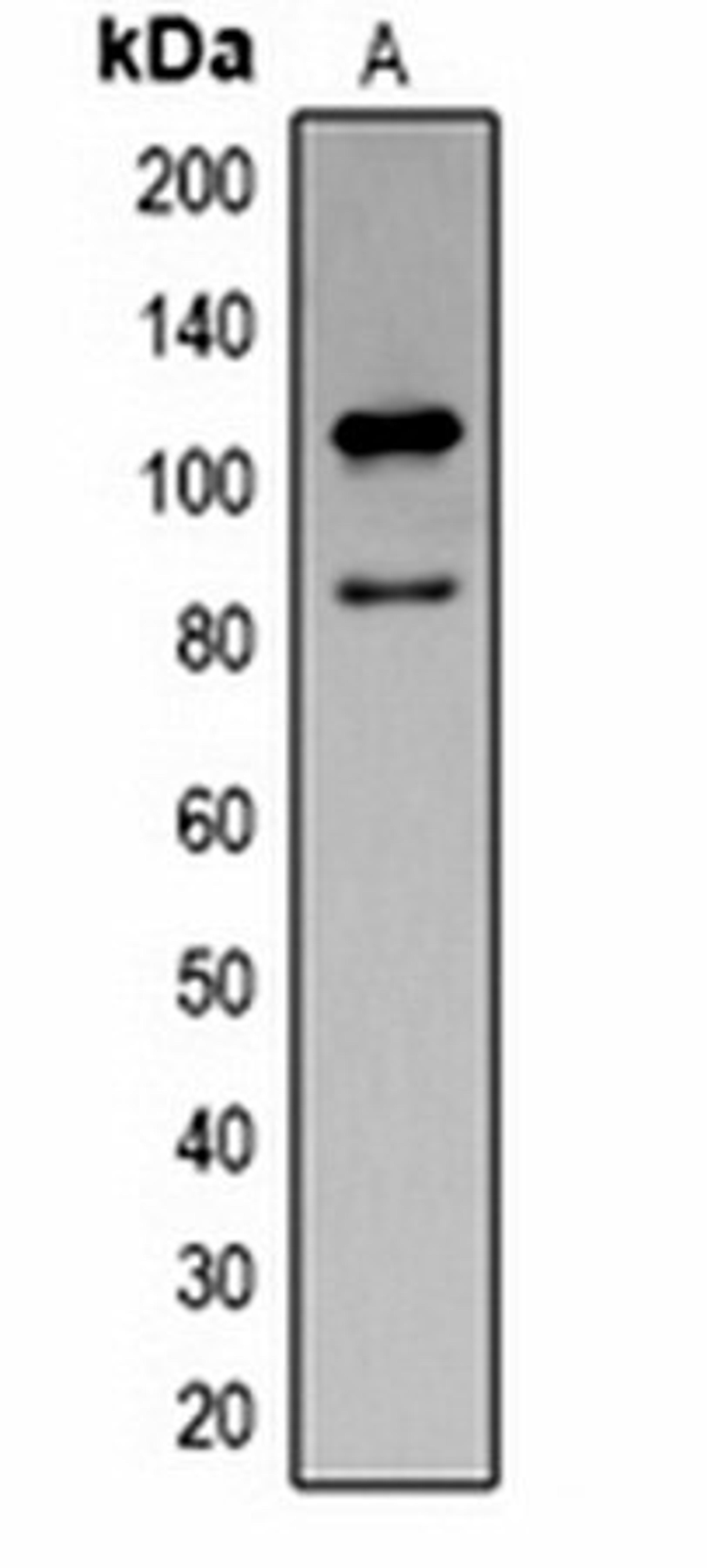 Western blot analysis of Jurkat (Lane 1) whole cell lysates using Cleaved PARP1 antibody