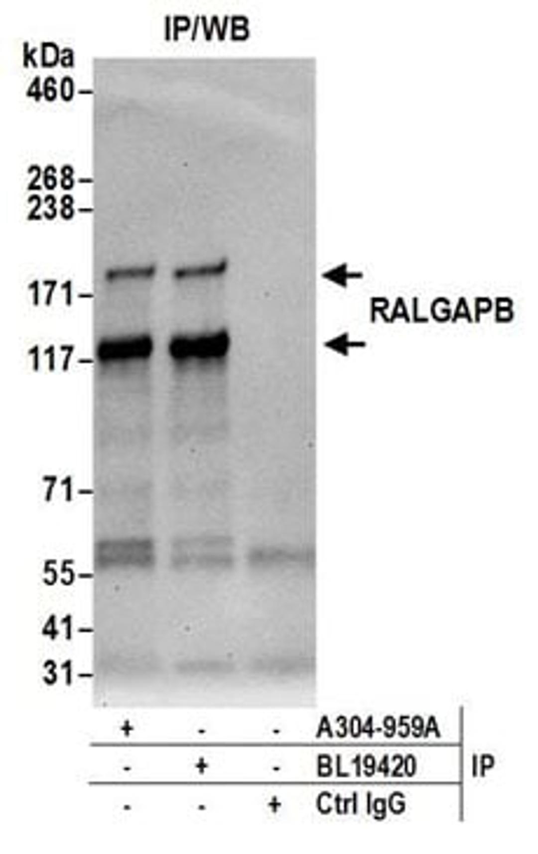 Detection of human RALGAPB by western blot of immunoprecipitates.