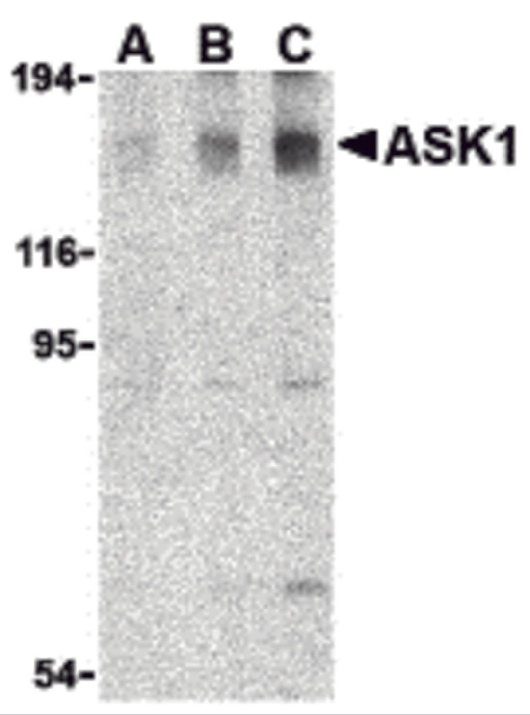 Western blot analysis of ASK1 in SW1353 cell lysate with ASK1 antibody at (A) 0.5, (B) 1, and (C) 2 &#956;g/mL. 