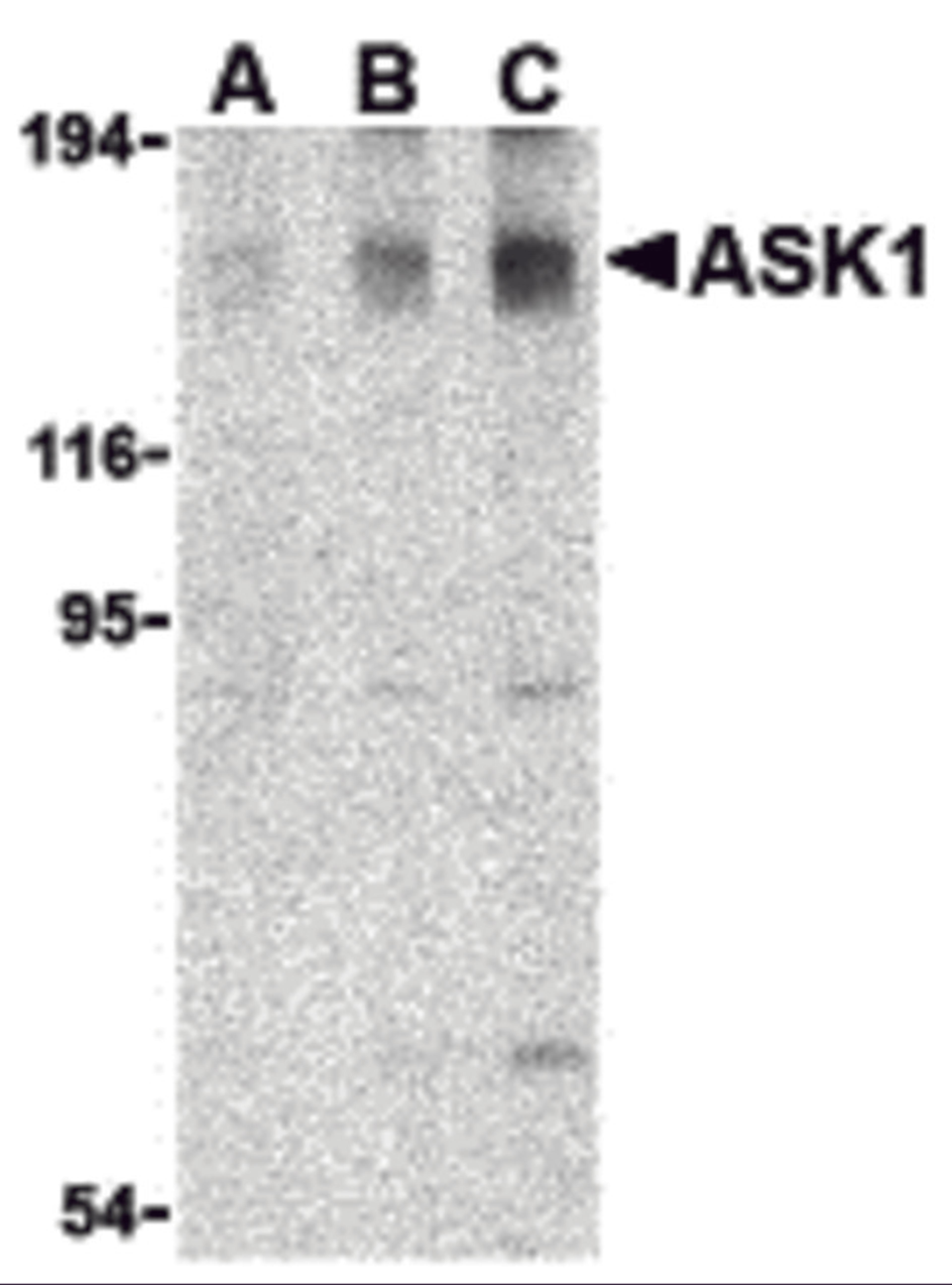 Western blot analysis of ASK1 in SW1353 cell lysate with ASK1 antibody at (A) 0.5, (B) 1, and (C) 2 &#956;g/mL. 