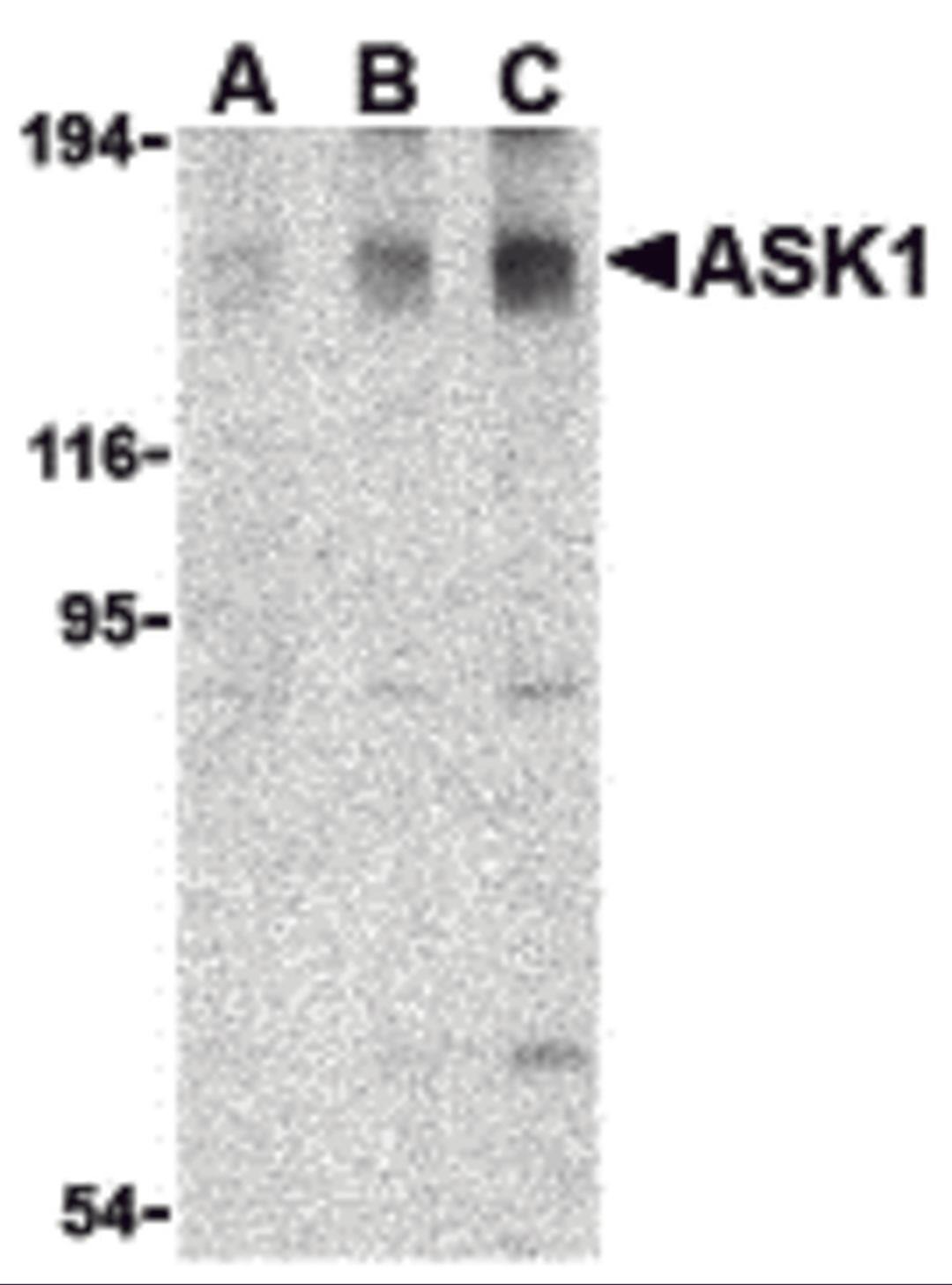 Western blot analysis of ASK1 in SW1353 cell lysate with ASK1 antibody at (A) 0.5, (B) 1, and (C) 2 μg/mL.