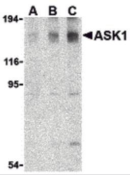 Western blot analysis of ASK1 in SW1353 cell lysate with ASK1 antibody at (A) 0.5, (B) 1, and (C) 2 μg/mL.