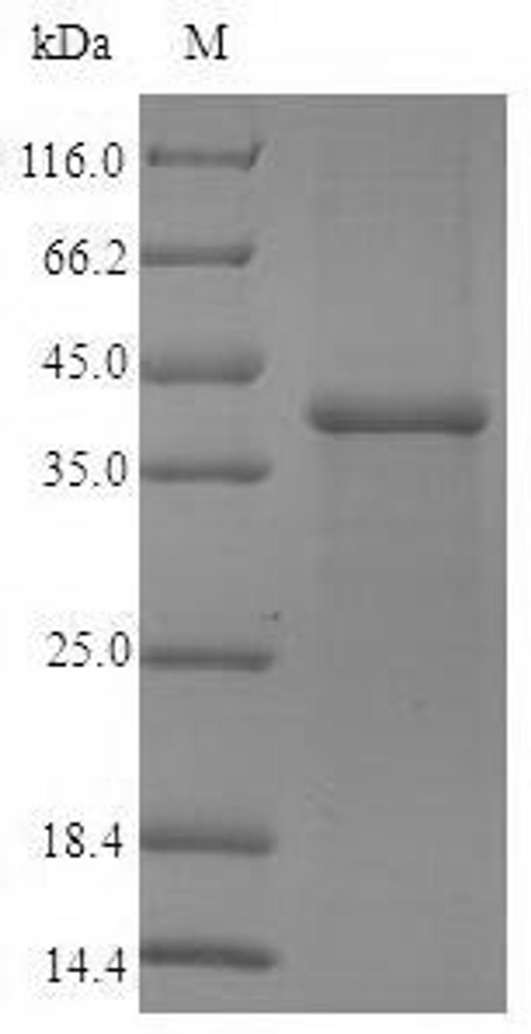 (Tris-Glycine gel) Discontinuous SDS-PAGE (reduced) with 5% enrichment gel and 15% separation gel.