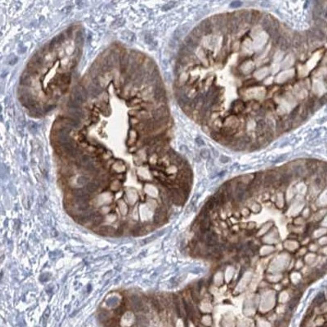 Immunohistochemistry: EPS8L1 Antibody [NBP2-32599] - Immunohistochemical staining of human placenta shows strong positivity in trophoblastic cells.